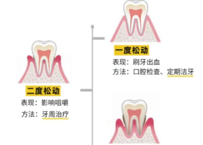 老年人牙齒松動了要怎么辦？
