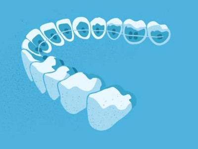 惟德口腔醫(yī)院口腔正畸好不好？